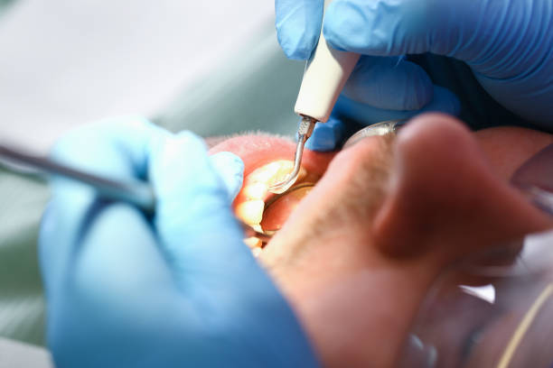 Best Pediatric Emergency Dentist in Tinley Park, IL