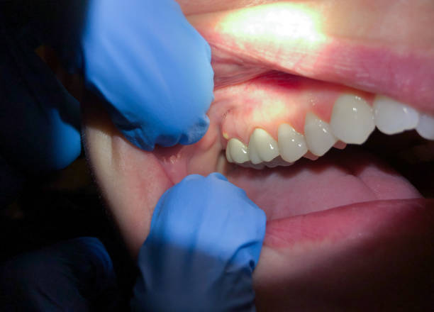Best Emergency Root Canal Treatment in Tinley Park, IL