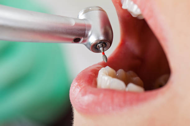 Best Emergency Dentist for Lost Fillings or Crowns in Tinley Park, IL